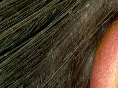 Víme jak na vši - Liběchov