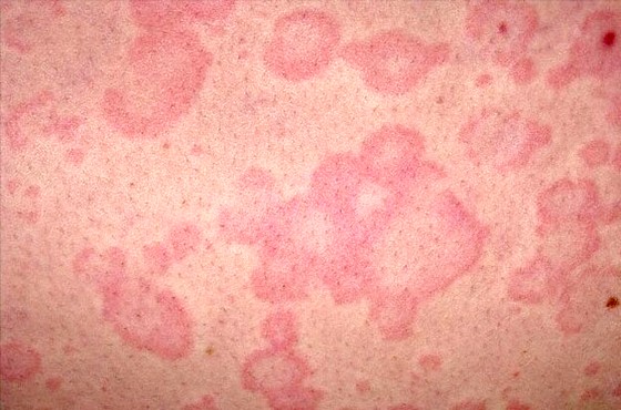 Likvidace švábů Praze 9